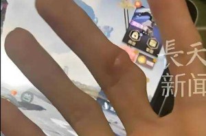 七手指：神秘现象、罕见病例与未解之谜全解析
