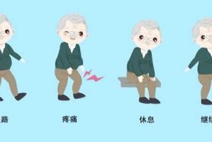 突发性下肢乏力原因探析与有效预防方法