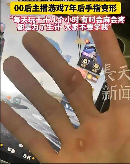 七手指:神秘现象、罕见病例与未解之谜全解析