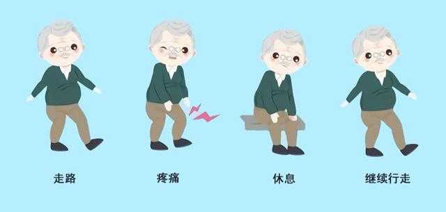 突发性下肢乏力原因探析与有效预防方法